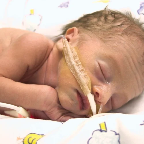 baby-oxygen-hospital-intensive-care-unit